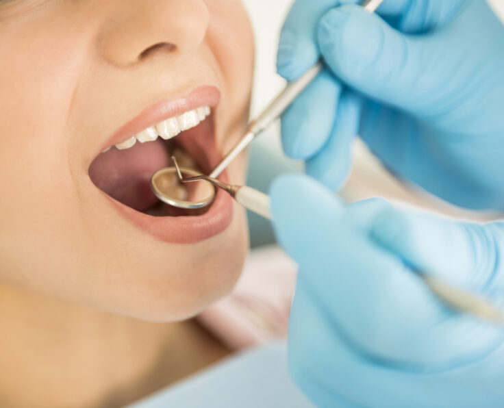Dentist examining a patient's teeth in the dentist.